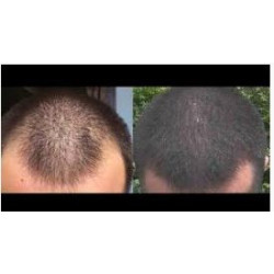 Hair tonic Pill food 120 capsules