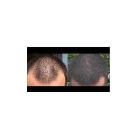 Hair tonic Pill food 120 capsules